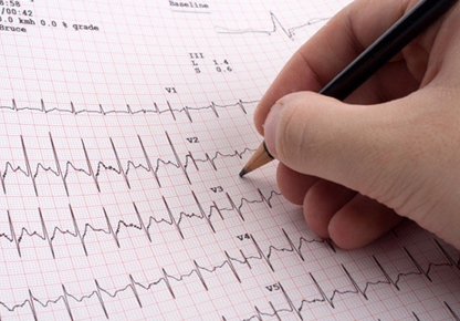 ECG Interpretation