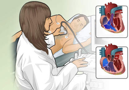 Echocardiography
