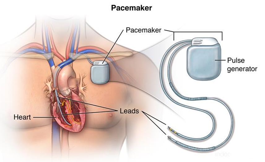 Advanced Laparoscopic Surgery: Why Minimally Invasive is the Gold Standard