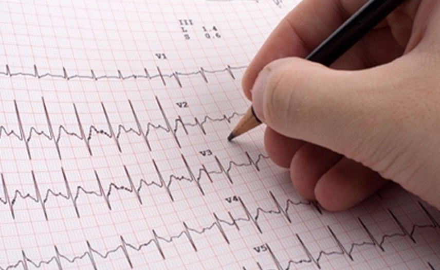ECG Interpretation in Kota