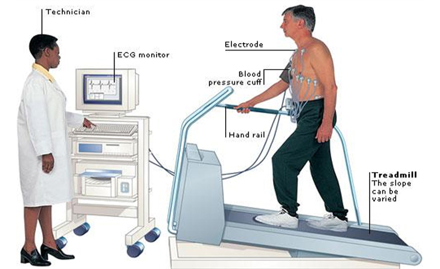 Cardiovascular Stress Test (TMT) in Kota