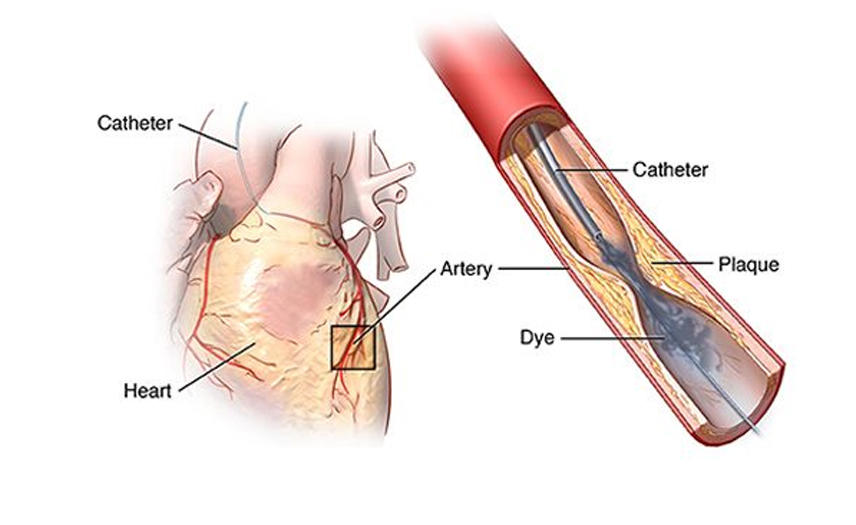 Recurrent Miscarriage Management in Kota