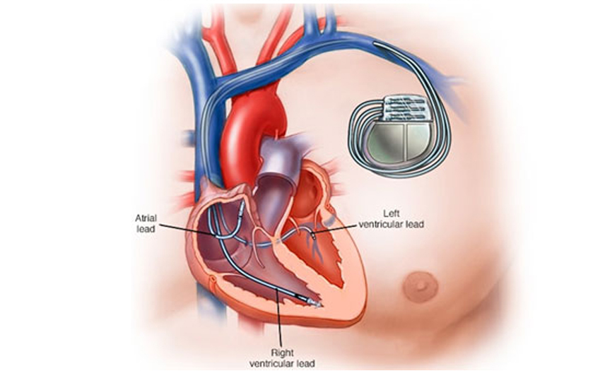 Ectopic Pregnancy Treatment in Kota